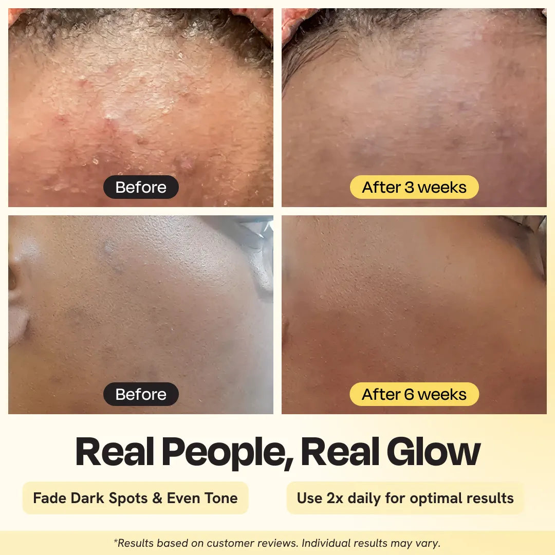 Crema Hidratante Iluminadora Avanzada